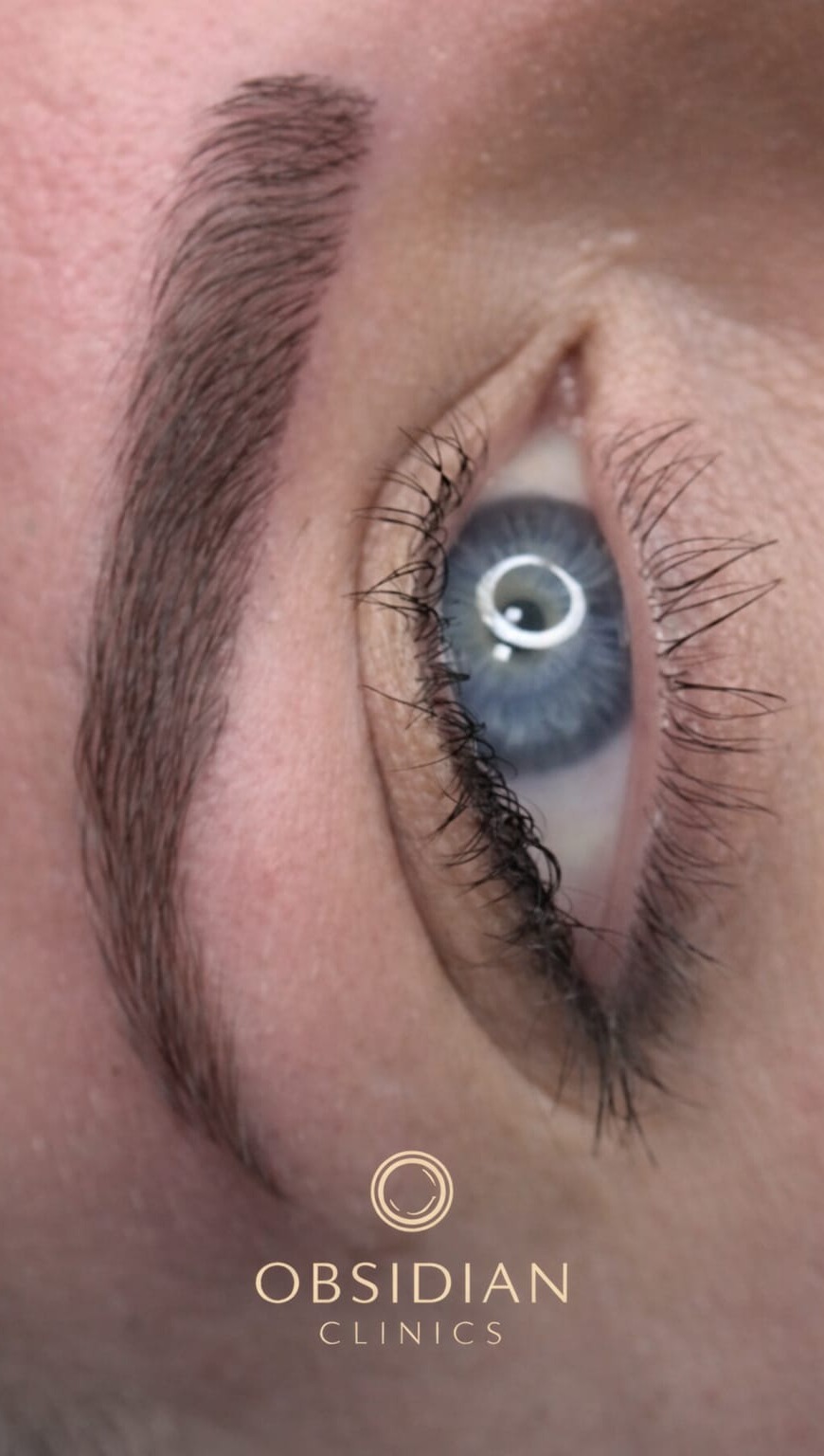 Combination brows treatment at Obsidian Clinics Glasgow