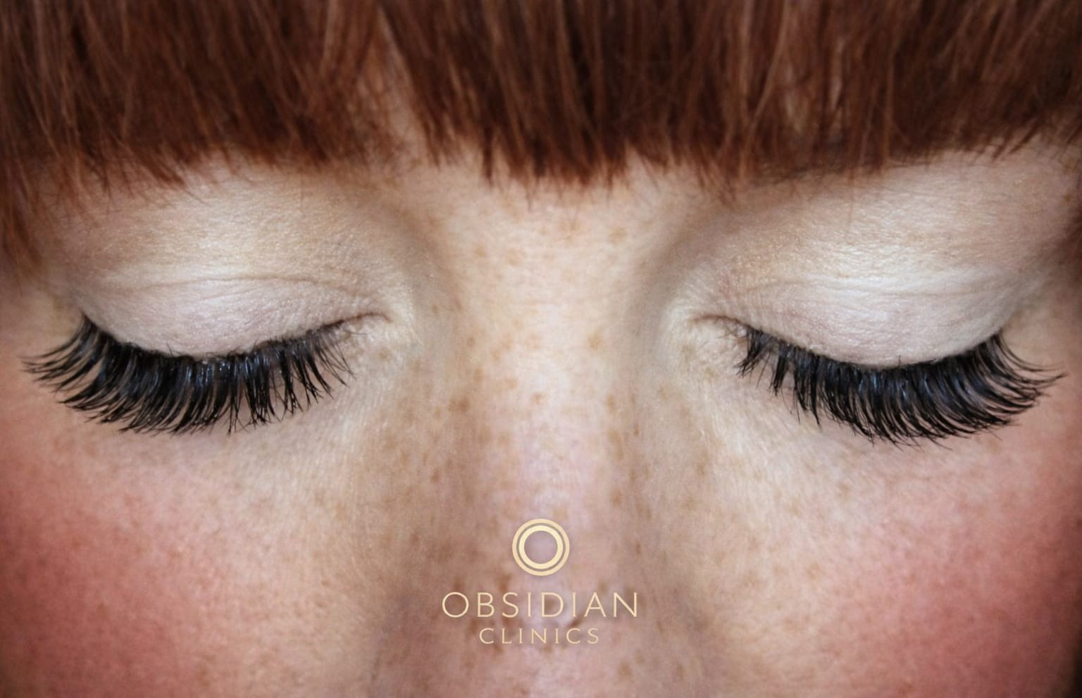 Close-up of lash extensions applied at Obsidian Clinics Glasgow