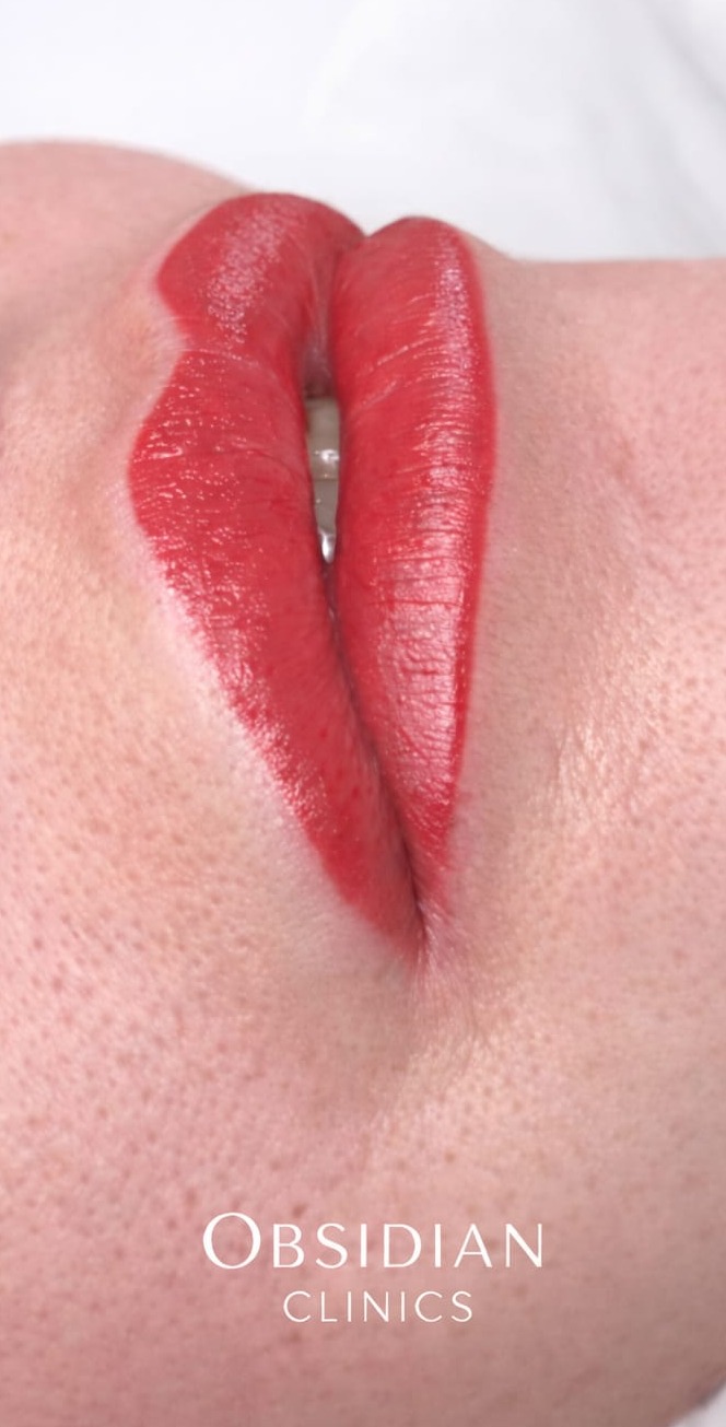 Lip blush treatment at Obsidian Clinics Glasgow