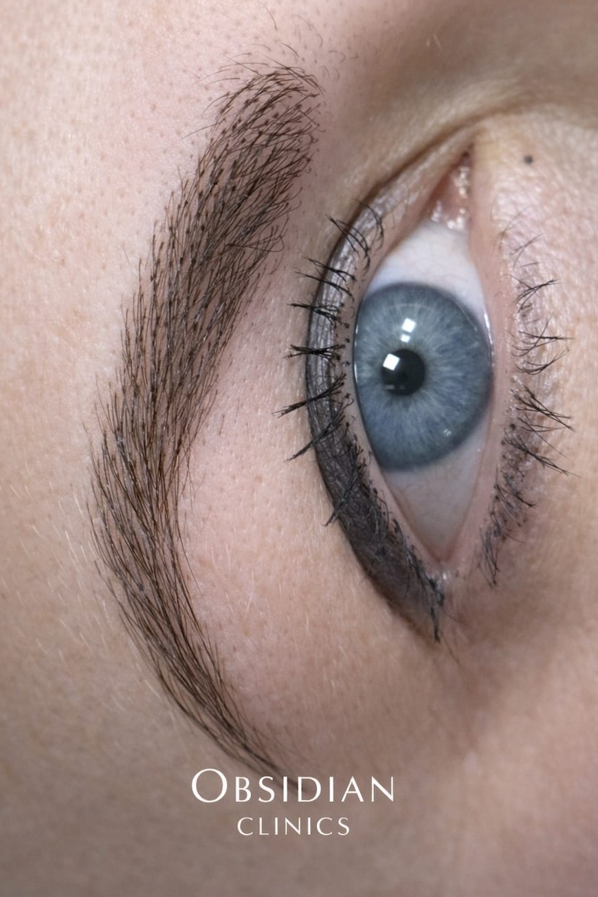 Microblading treatment at Obsidian Clinics Glasgow