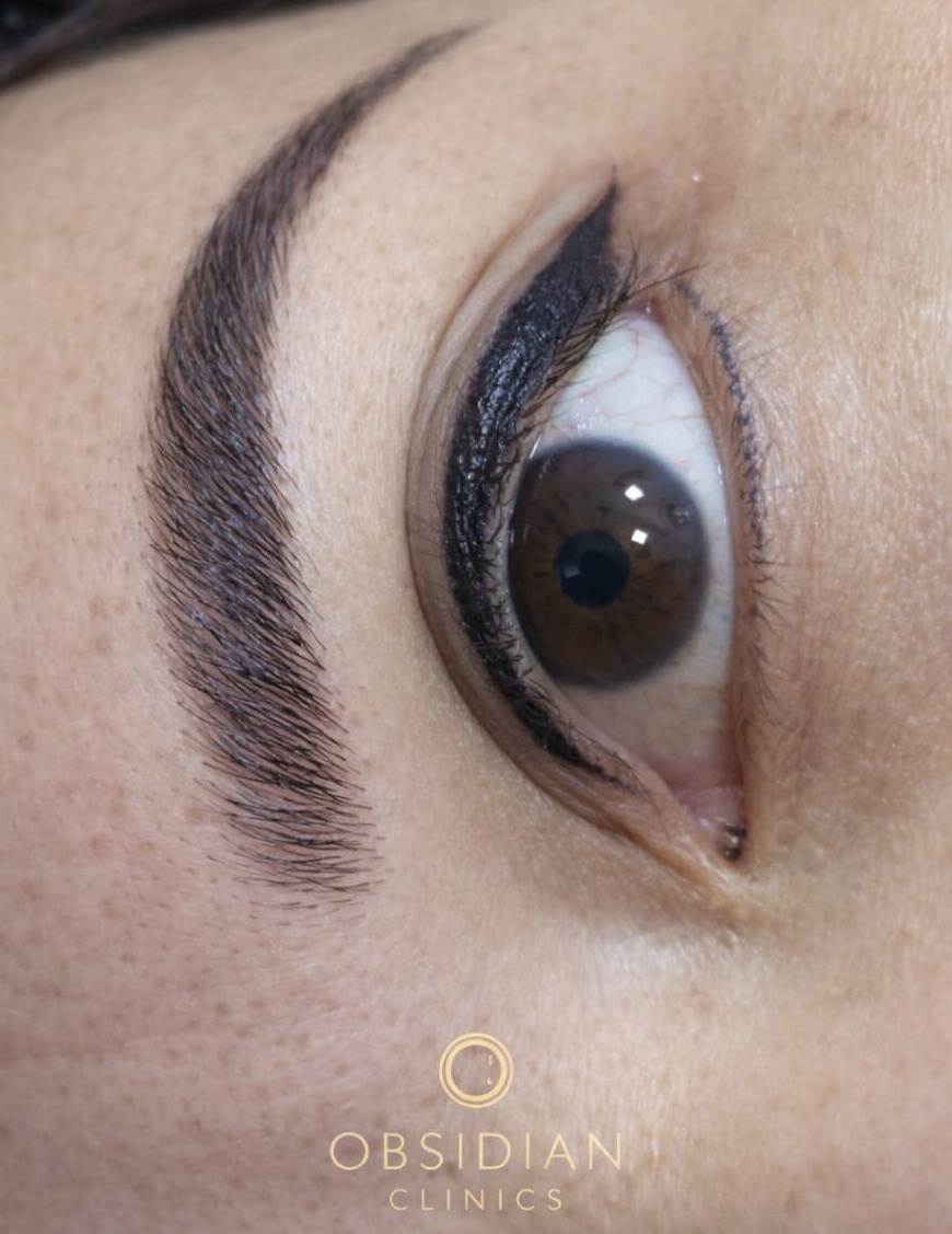 SPMU eyeliner treatment at Obsidian Clinics Glasgow